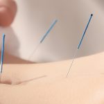 banner acupuntura