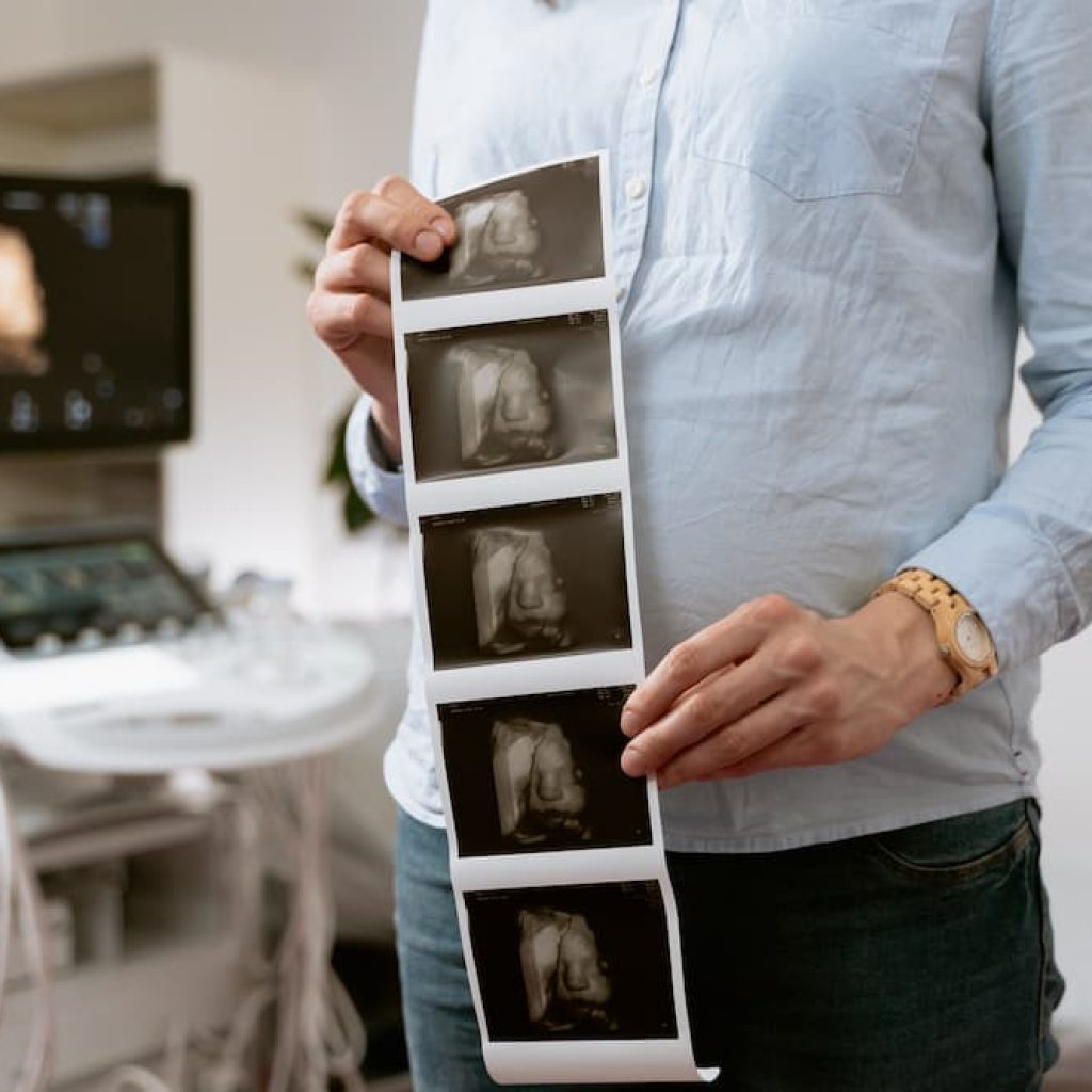 ¿Qué probabilidades de embarazo múltiple hay con técnicas de reproducción asistida?