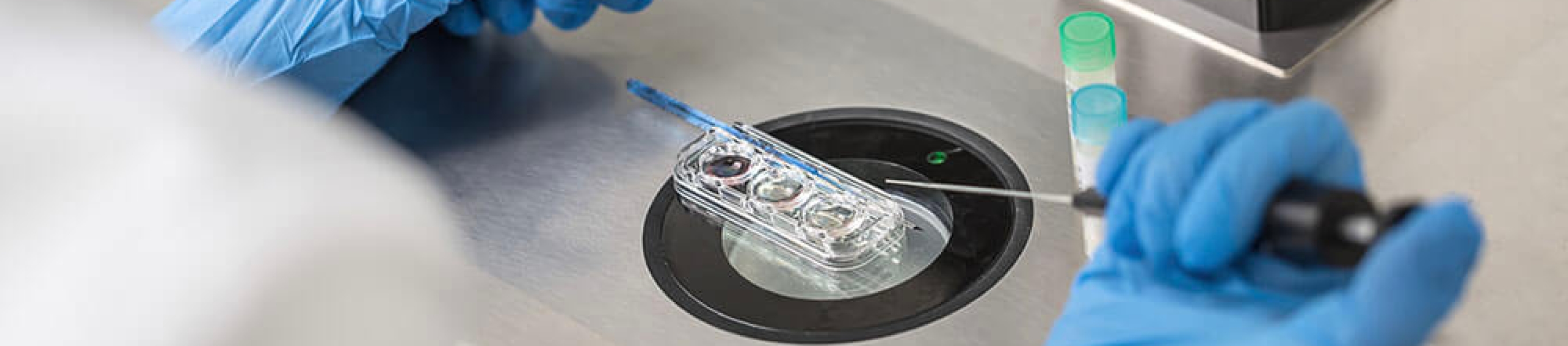 Causes of failure of intrauterine artificial insemination - Fertilab ...